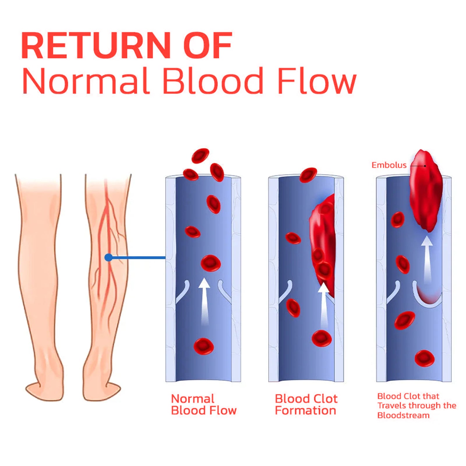 Acupressure Support Insoles